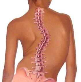 The curvature of the spine leads to osteochondrosis